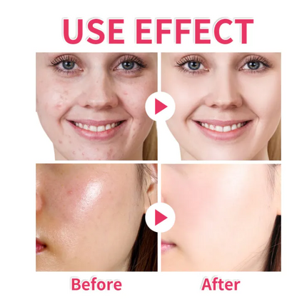 Turmeric Kojic Cleansing Pads